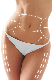 Vaser Liposuction