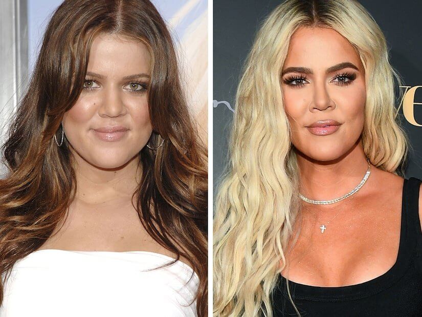 Chirurgies plastiques de Khloé Kardashian