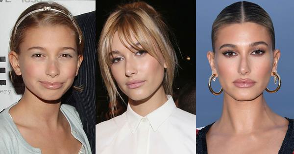 Les Chirurgies Plastiques de Hailey Baldwin