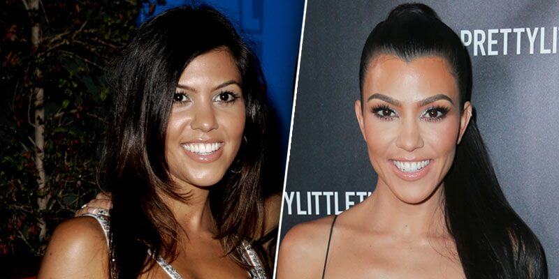 Kourtney Kardashian Plastic Surgery