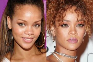 rihanna estetik ameliyatları