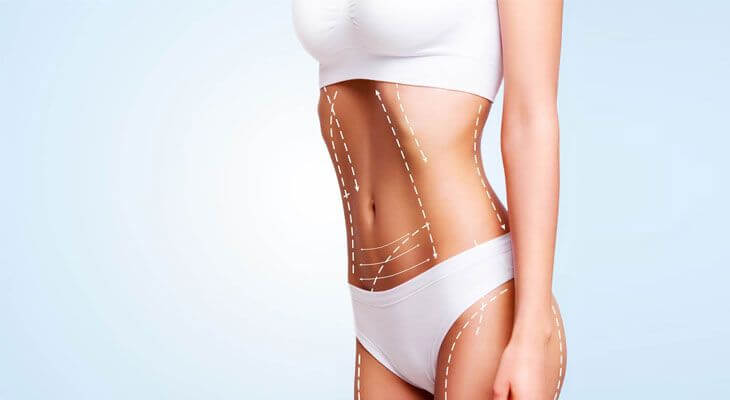 Vaser Liposuction Ve Liposuction Arasındaki Farklar