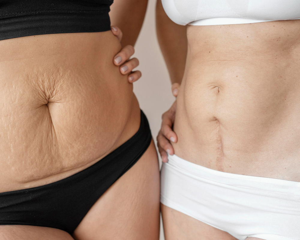 close-up-women-posing-together