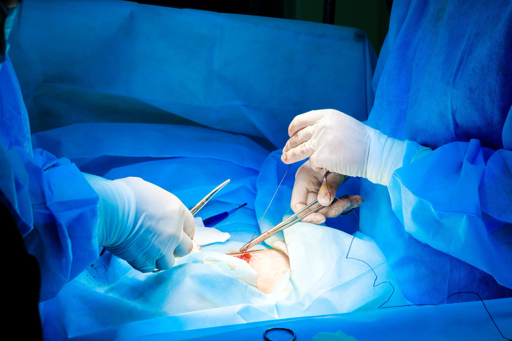 surgeons-sew-up-patient-s-skin-end-surgical-operation-selective-focus-doctor-s-hands-sterile-gloves-with-needle-thread-sew-up-incision-human-skin