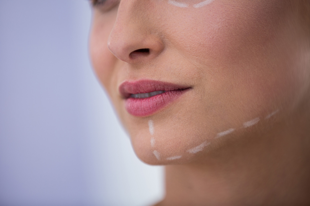 woman-with-marks-drawn-cosmetic-treatment-her-jaw