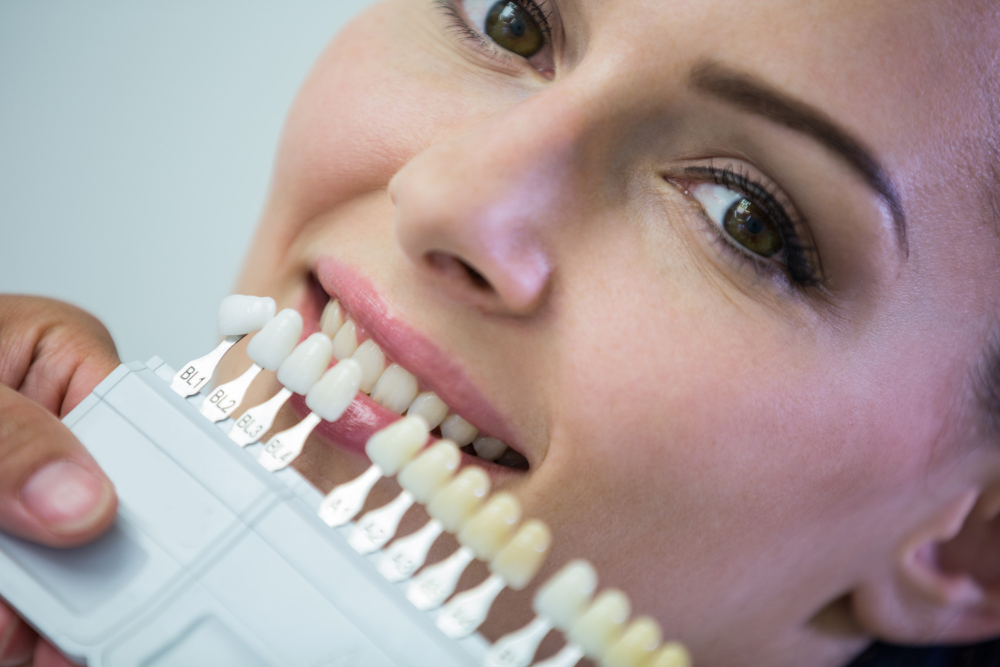 Dental Implants 3