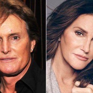 Caitlyn Jenner Plastic Surgery