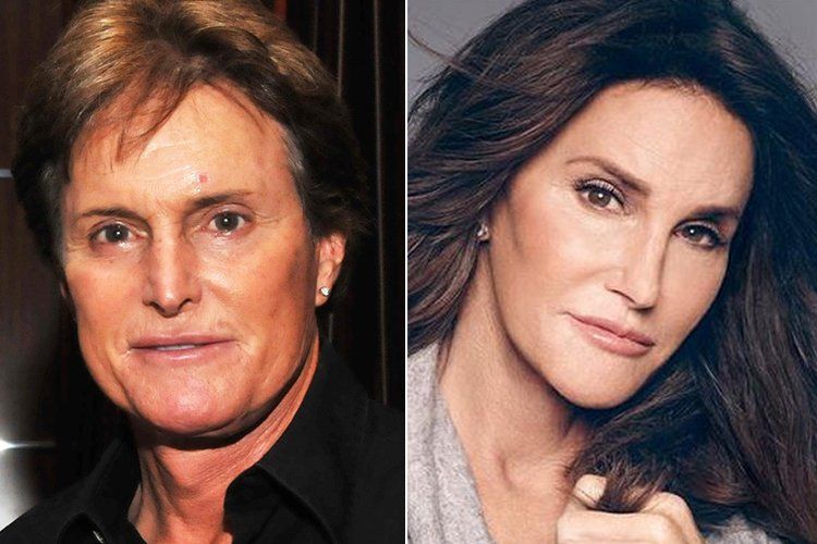 Caitlyn Jenner Plastik Cerrahi