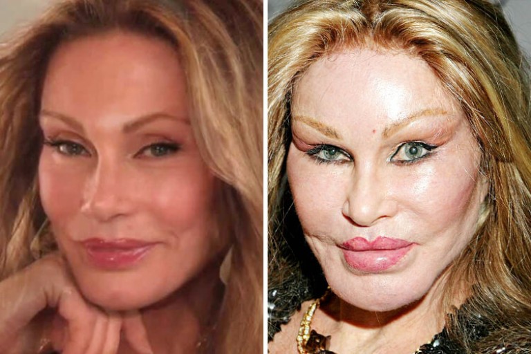 plastic surgery gone wrong (3)